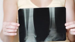 Dianggap Silent Disease