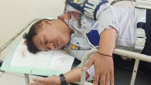 Teguran Parkir Berujung Kekerasan: Petugas Dishub Dilukai di Bandung