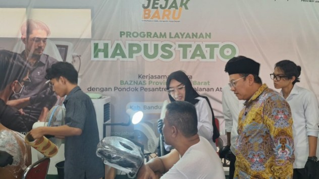 Hapus Tato Gratis BAZNAS Jabar Bantu Warga Buka Peluang Kerja